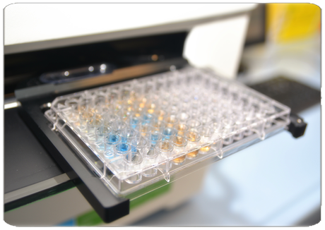 Studio Biogem-Vanvitelli identifica nuovo soppressore del carcinoma epatocellulare