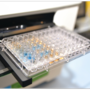 Studio Biogem-Vanvitelli identifica nuovo soppressore del carcinoma epatocellulare